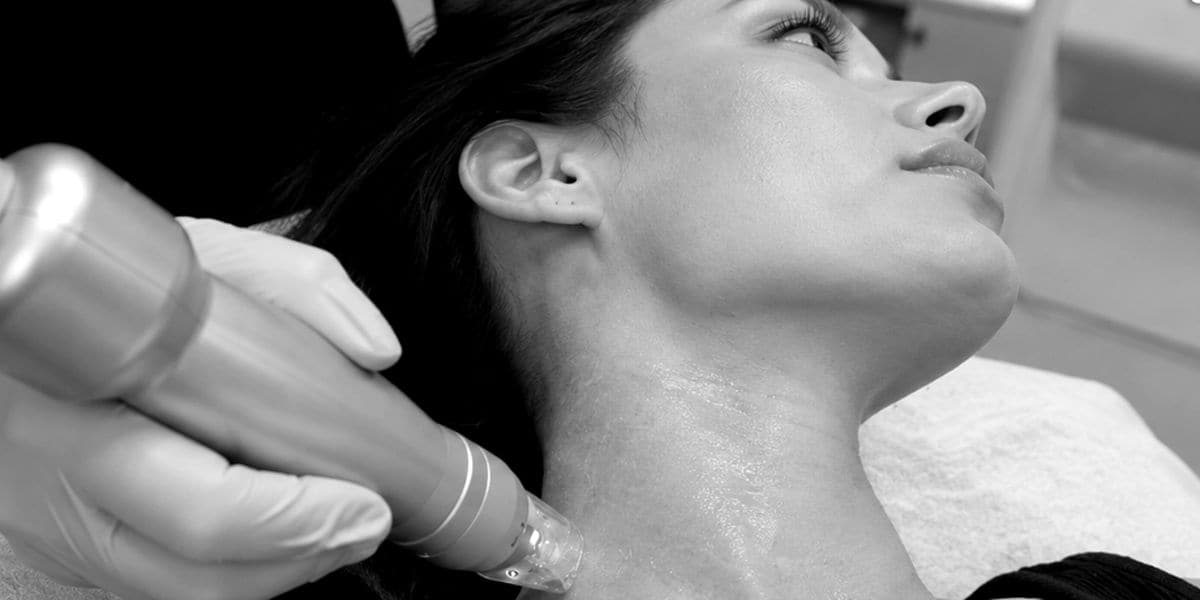 A Scarlet RF microneedling handpiece on a client’s neck